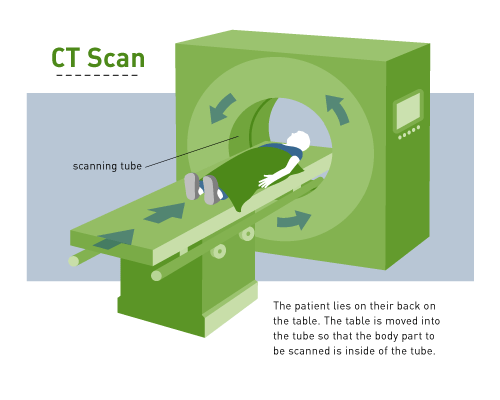 Ct Scan setup